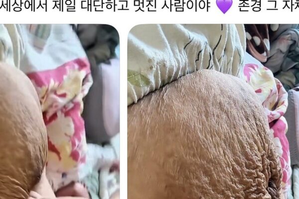 엄마의 훈장 vs TMI? 인터넷 뒤집어놓은 ‘현실 출산 배’ 사진 논란