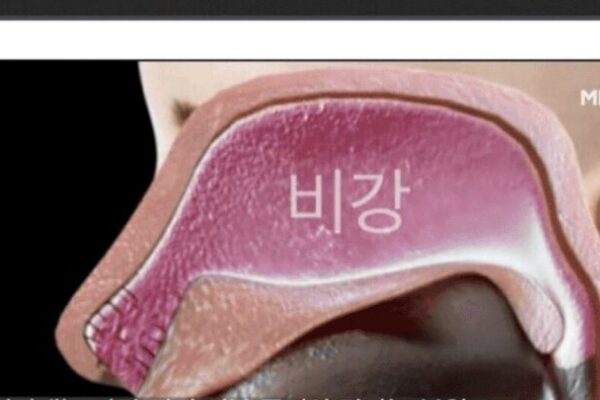 El Lado Oscuro del K-Medical: Los Peligros de la Cirugía de Rinitis